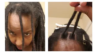 Another Way To Maintain Your New Growth❗| BRAIDED Roots