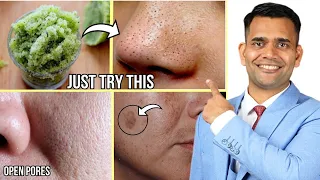 Get Rid Of Dark Spots, Open pores , Blackheads  Naturally at Home - Dr. Vivek Joshi