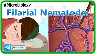 Filarial nematodes Animation🐛: Wuchereria, onchocera volvulus, Loa-Loa, Dracunculus, Trichinella