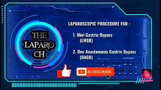 Laparoscopic Mini Gastric Bypass MGB OAGB Laparoscopic Surgery