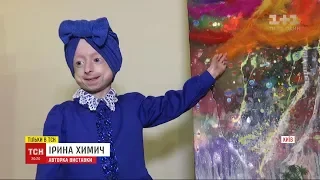 Дівчинка з унікальною хворобою малює картини, аби зібрати кошти собі на лікування