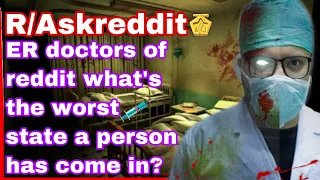 ER doctors of reddit what's the worst state a person has come in?