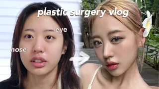 Plastic surgery vlog….! I got my nose & eyes done | 저 성형했어요…! 눈과 코 같이 한 리얼 후기