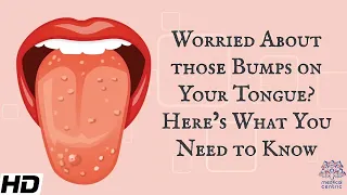 Worried About Those Bumps on Your Tongue? Here's What You Need To Know