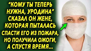 "Кому ты теперь нужна такая" сказал он жене, которая пыталась спасти его из пожара, но позже…