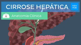 Cirrose hepática: Causas, sintomas, tratamento e prevenção | Kenhub