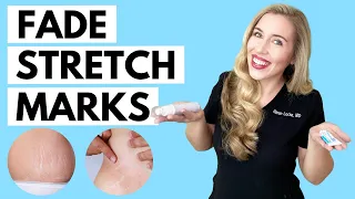 Fade Stretch Marks! | Ingredients that WORK and the Science to Back it up