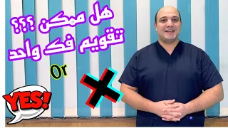 تقويم الأسنان | هل ممكن أعمل تقويم فك واحد ؟