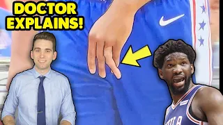 Joel Embiid DISLOCATES His Finger - Doctor Explains the Injury