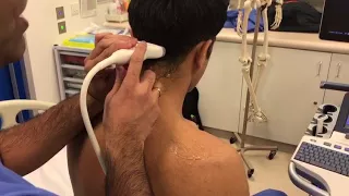 Greater Occipital Nerve Block