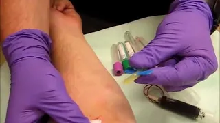 Phlebotomy | Butterfly needle