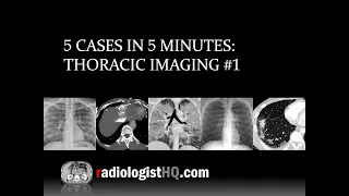 5 Cases in 5 Minutes: Thoracic #1