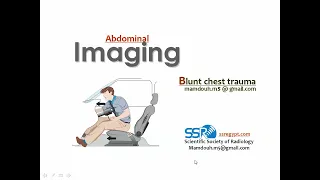 Imaging of Blunt chest trauma (DRE) Prof. Mamdouh Mahfouz