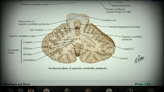 Анатомия с АВ. Ромбовидный мозг (rhombencephalon).