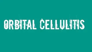 Ophthalmology: Orbital cellulitis