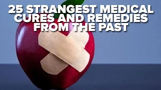 25 Strangest Medical Cures And Remedies From The Past