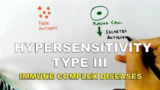 Hypersensitivity Type III or Immune Complex Diseases