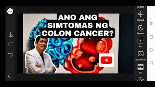 ANO ANG SIMTOMAS NG COLON CANCER?