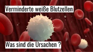 Leukozytopenie - was ist die Ursache verminderter weißer Blutkörperchen