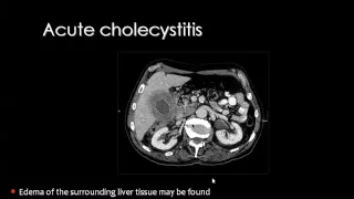 Imaging of Biliary System   DRE 9   Dr Mamdouh Mahfouz New