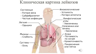 4 курс СФ. Лекция на тему: "Заболевания крови. Гемобластозы".