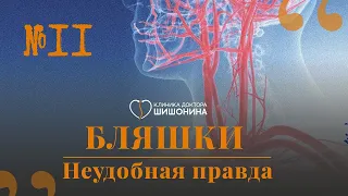 Бляшки и как с ними жить 💊 доктор  Шишонин встретился с сосудистым хирургом – А. А. Шубиным!