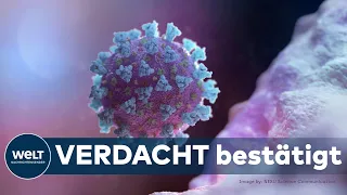 CORONA-MUTATION: Neue Coronavirus-Variante in Niedersachsen nachgewiesen