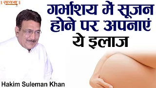 गर्भाशय में सूजन होने पर अपनाएं ये इलाज। Hakim Suleman Khan। Sadhna TV