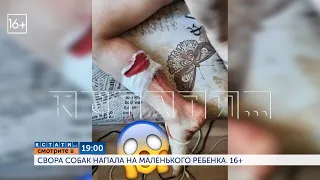 Смотрите сегодня в 19.00 на телеканале "Диалог": Свора собак напала на маленького ребенка