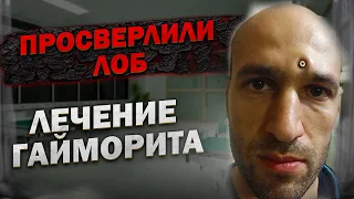 Ошибки при лечении гайморита. Возможно ли лечение гайморита в домашних условиях