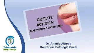 09/10/2018 - Queilite actínica