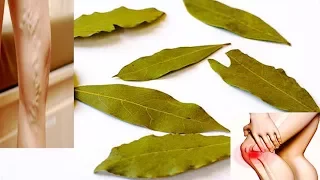 With This Leaf You No More Varicose Veins, No Joint Pains and No Headaches