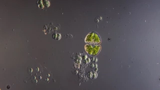 Десмидиева водоросль под микроскопом