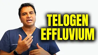 Telogen Effluvium Hair Loss