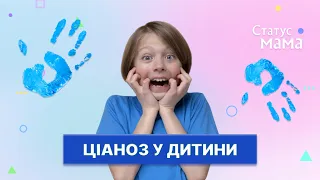 Ціаноз носогубного трикутника у немовлят | Статус МАМА