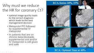 Medications for Cardiac CT