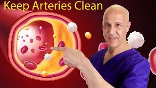 Prevent Calcium Build-Up in Arteries (Prevent Heart Attack) | Dr. Mandell