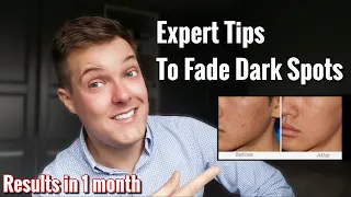 How to FADE DARK SPOTS FAST | Tackle hyperpigmentation fast - The Ordinary for dark spots