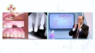التقنيات الحديثة لزراعة وتركيبات الأسنان | الدكتور أشرف كامل رفعت | برنامج صحتك | 10-11-2023