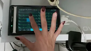 NeoECG S120 Demonstrated by Cardiologist