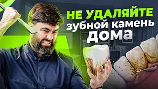 Удаление зубного камня в домашних условиях – ПОСЛЕДСТВИЯ