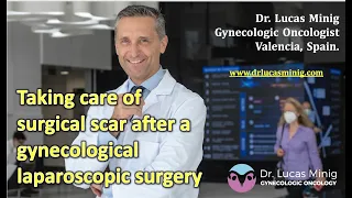 ✅ Taking care of surgical scar after a gynecological laparoscopic surgery. Dr Lucas Minig. Valencia