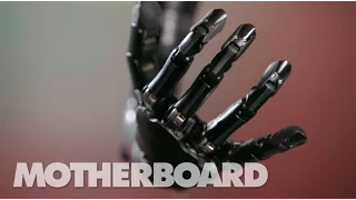 The Mind-Controlled Bionic Arm With a Sense of Touch