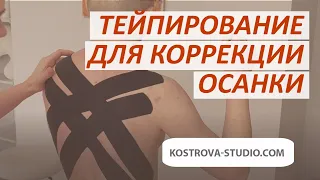 Тейпирование для коррекции осанки