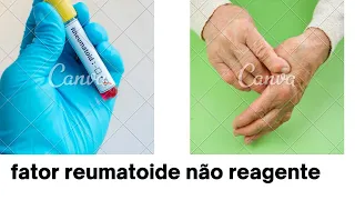 fator reumatoide não reagente#@ARTRITE MUITO ALÉM DAS JUNTAS