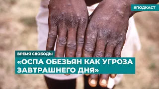 Оспа обезьян как угроза завтрашнего дня | Информационный дайджест «Время Свободы»