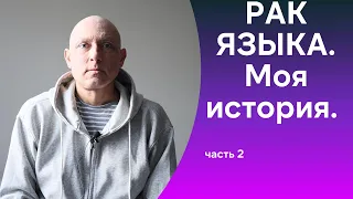 Рак языка.Моя история