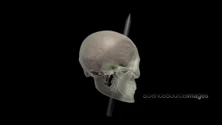 PHINEAS GAGE AND HIS BRAIN INJURY, ANIMATION