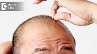 Is early hair loss a sign of future extensive balding? - Dr. K Prapanna Arya