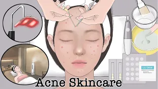 Skin Care Animation full version / Pimple popping / Acne Laser treatment